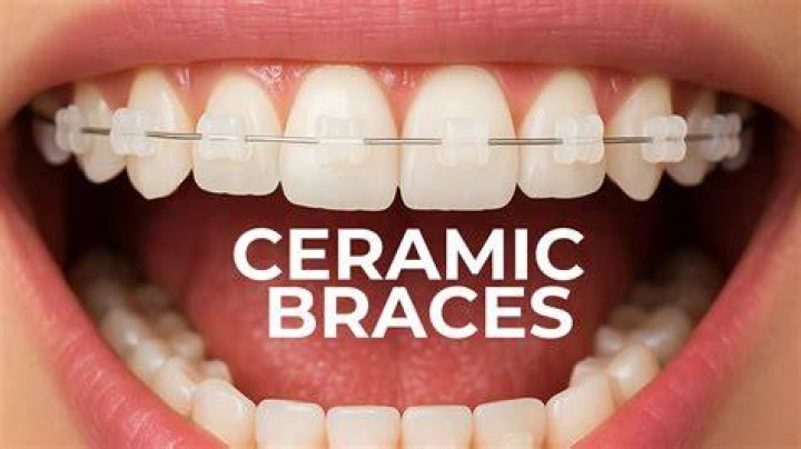 Affordable Braces Fresno CA