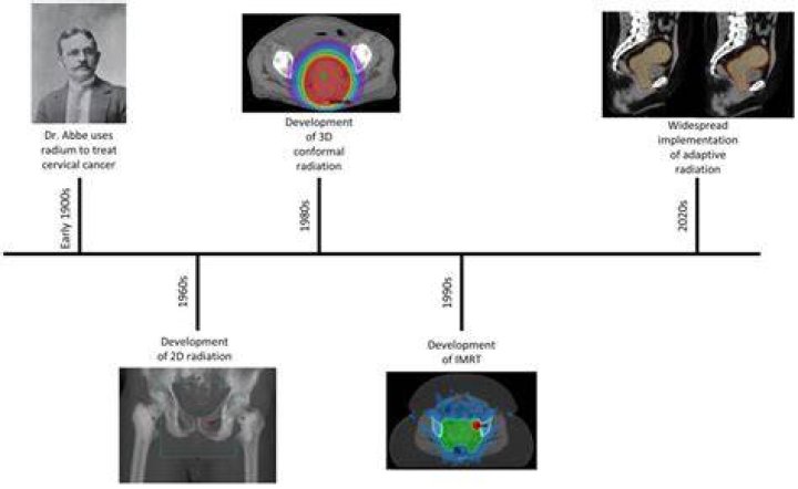 Alice Stewart's Husband And His Role In Radiation Research