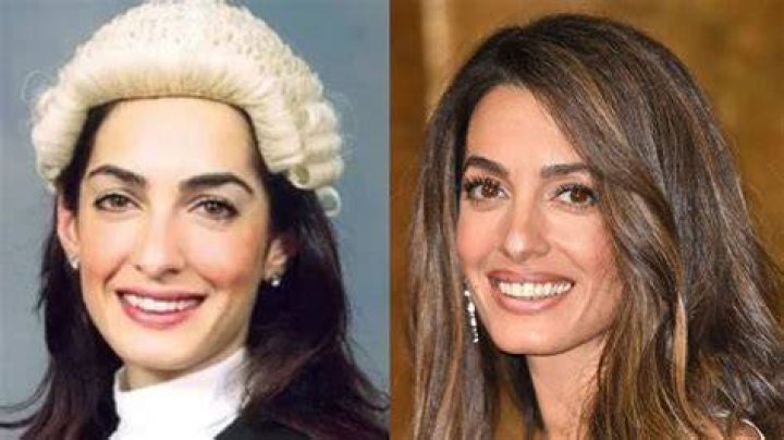 Amal Clooney's Plastic Surgery Journey