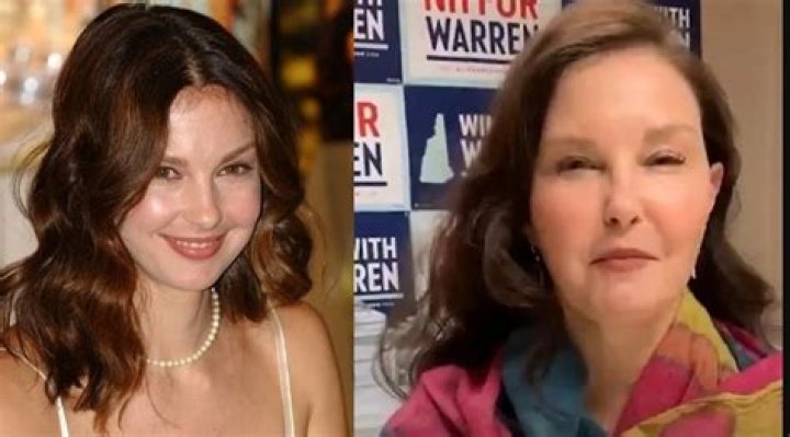 Ashley Judd's Facial Transformation: The Truth Behind The Rumors