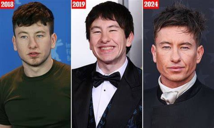 Barry Keoghan's Plastic Surgery: Before And After Transformation