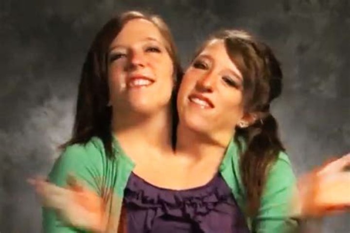 Conjoined Twins Abby and Brittany Hensel: Now Teachers