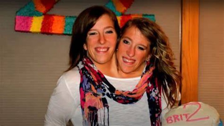 Conjoined Twins Abby And Brittany Today: Unraveling The Enigma