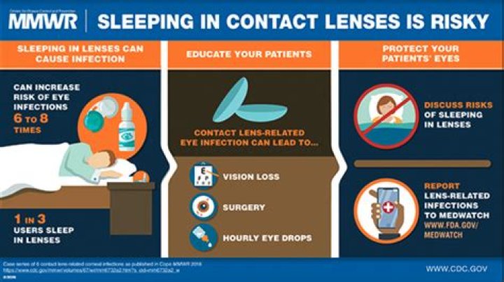 Dangers of Sleeping in Contacts: Infections & More
