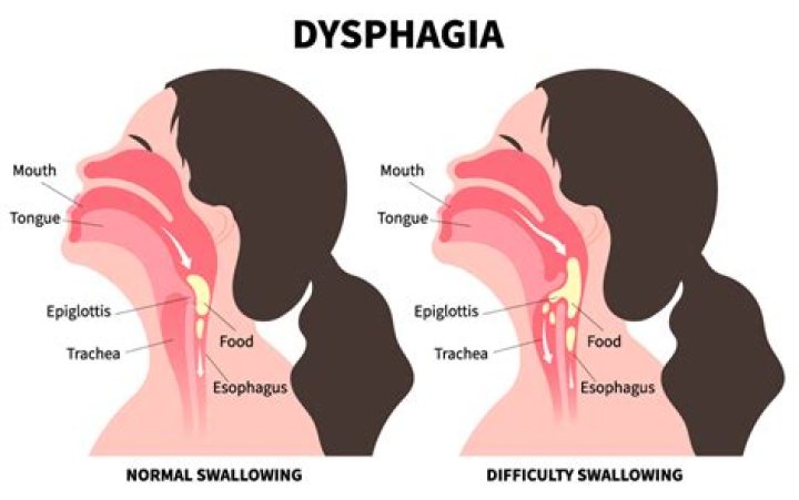 Dangers of Swallowing a Bullet: Lead Poisoning & More