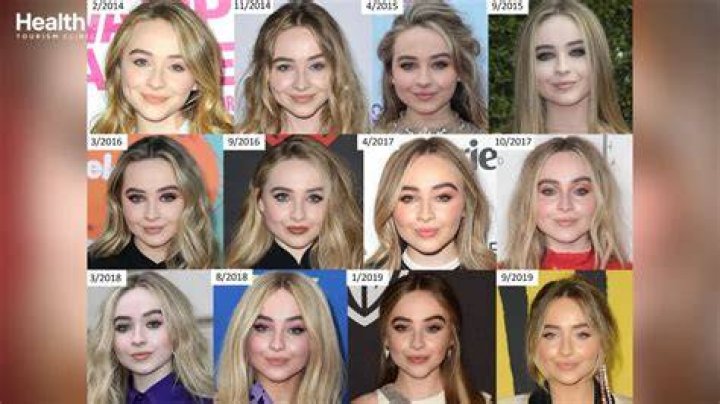 Debunking Plastic Surgery Rumors: The Truth About Sabrina Carpenter's Appearance