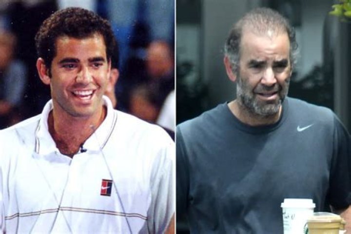 Discover The Secrets Of Pete Sampras's Net Worth
