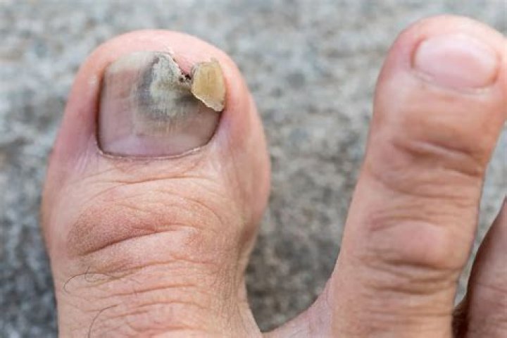 Discoveries And Insights With "The Toe Bro" Jonathan Tomines
