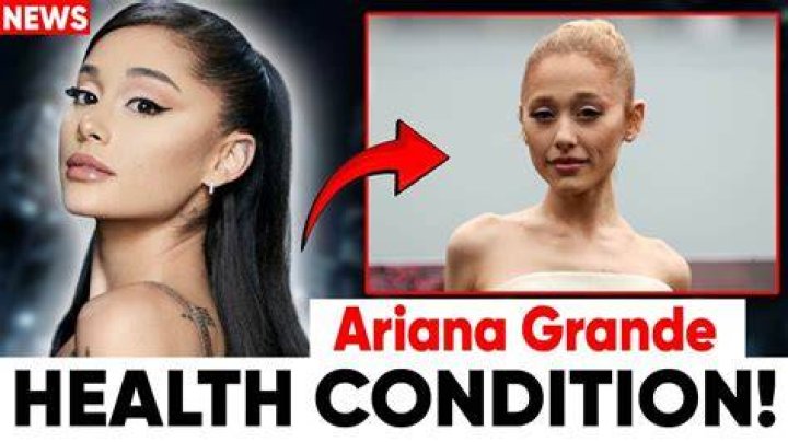 Does Ariana Grande Have Cancer, And Other Unforeseen Medical Conditions