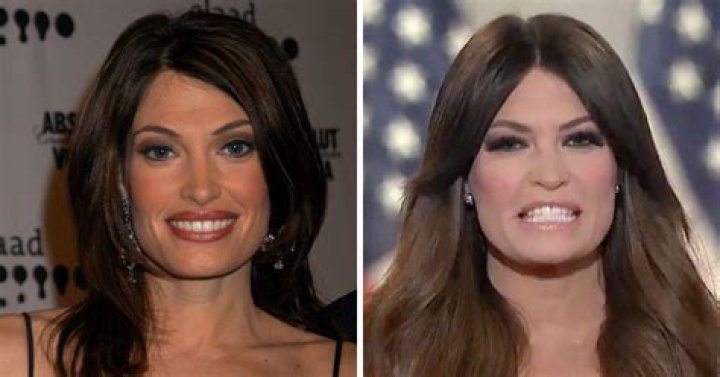 Dramatic Transformation: Guilfoyle Before And After