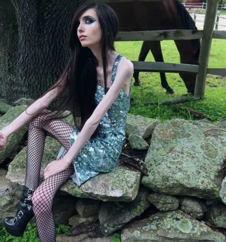 Eugenia Cooney's Weight And The Complexities Of Eating Disorders