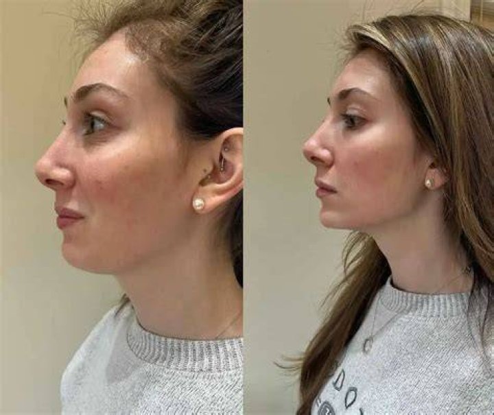 Exploring The Charismatic Jude Bellingham Jawline: More Than Just A Facial Feature