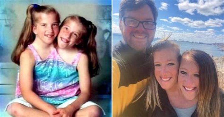 Exploring The Lives Of Abby And Brittany: Are They Still Alive?