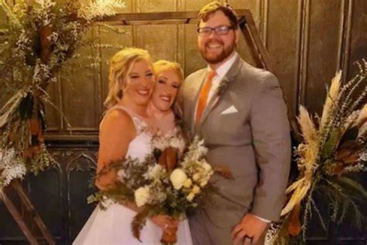 Exploring The Lives Of Abigail And Brittany Hensel: Are They Pregnant?