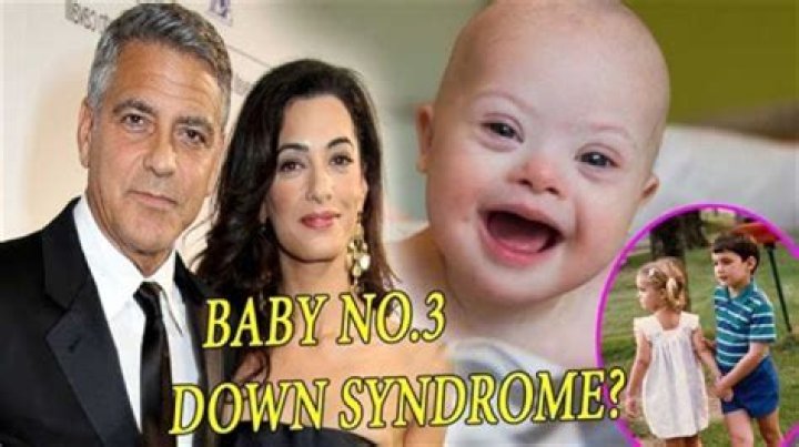 George Clooney's Journey: Embracing His Child's Down Syndrome