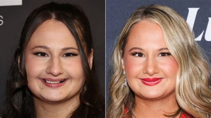 Gypsy Rose Blanchard's New Look: Nose Transformation Unveiled!