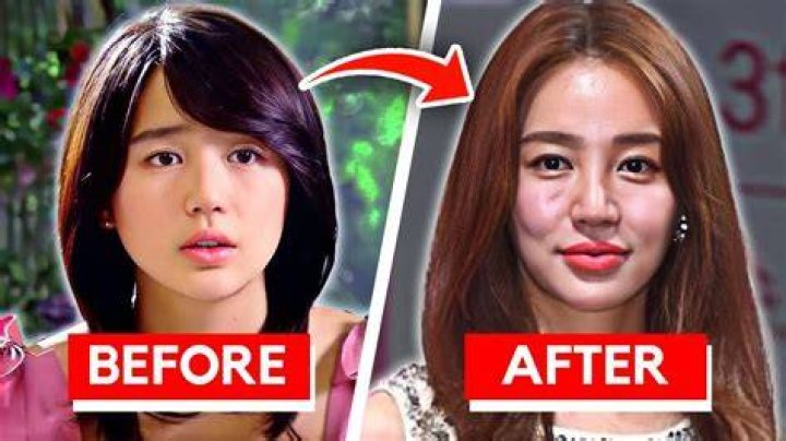 Hikaru Nagi Plastic Surgery: Truth or Rumors?