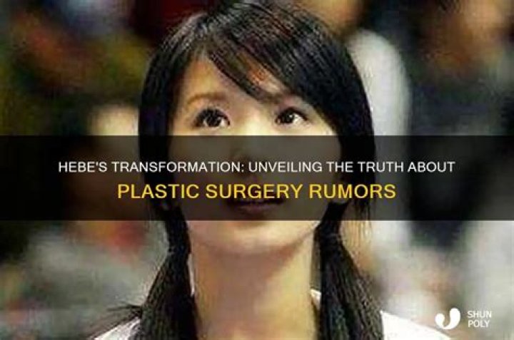 Hikaru Nagi: Truth About Plastic Surgery Rumors