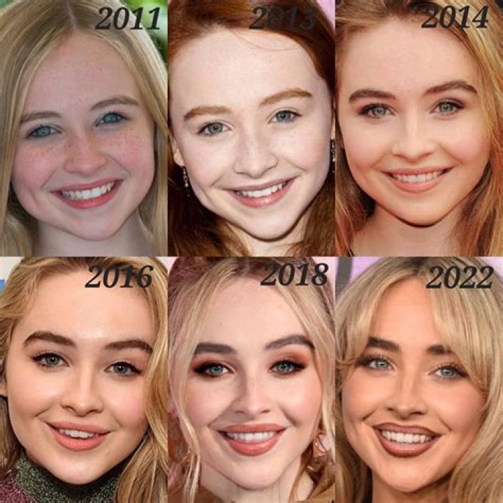 Inside The Transformation: Sabrina Carpenter's Plastic Surgery Journey