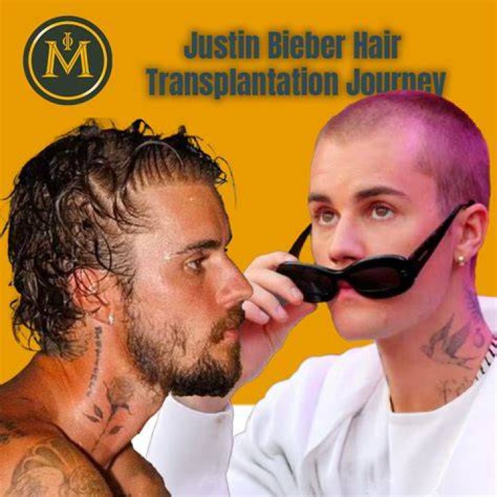 Is Justin Bieber Alive? The Journey Of A Music Icon