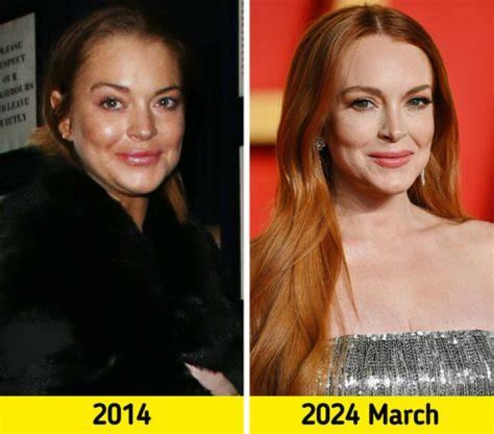 Kimberly Guilfoil's Plastic Surgery Transformation: Before And After Photos