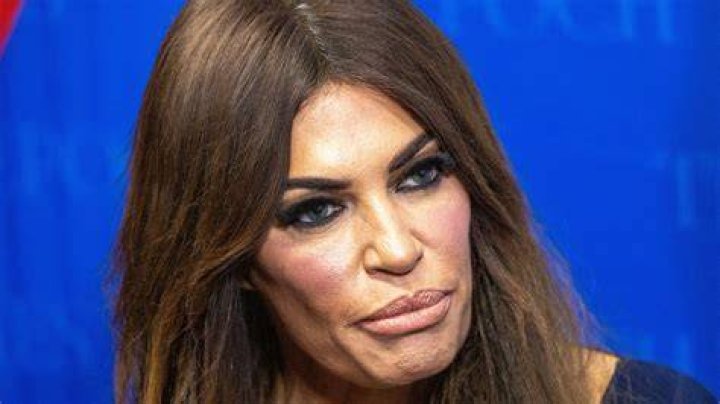 Kimberly Guilfoyle: Unveiling Her Pre-Botox Transformation
