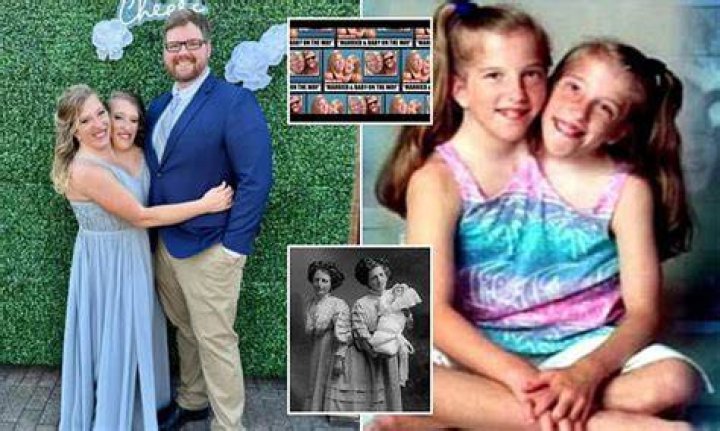 Life’s Twists: The Journey Of Conjoined Twins Abby And Brittany Pregnant