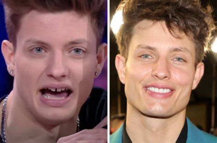 Matt Rife Then And Now: A Look At His Old Photos