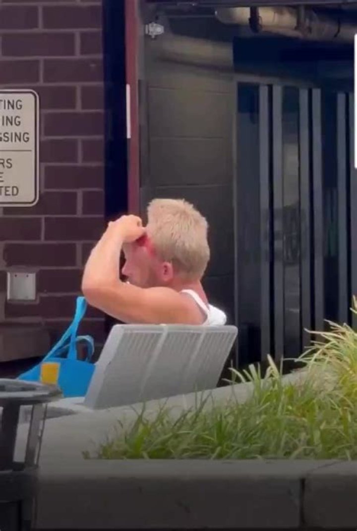 Nashville Man Missing Part of Skull: Shocking Story