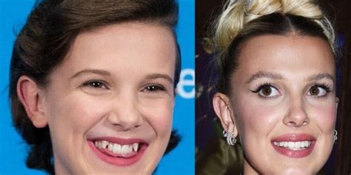 Nelly Furtado: Beauty, Evolution, And The Plastic Surgery Rumors