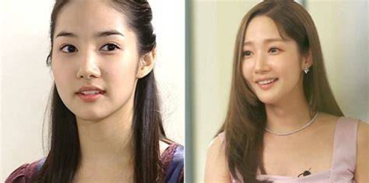Park Min Young's Candid Journey With Plastic Surgery