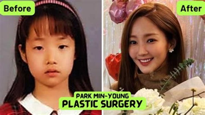 Park Min Young's Plastic Surgery Journey Revealed