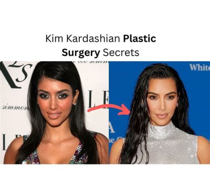 Plastic Surgery Secrets Of Karol G: Unveiled And Analyzed