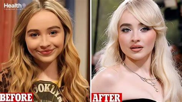 Sabrina Carpenter's Transformation: A Look At Her Before And After Surgery
