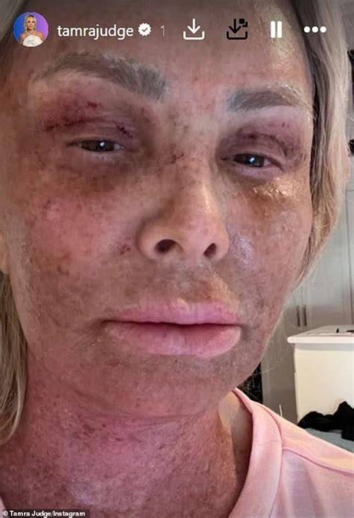 The Real Age Of Tamra Judge: Uncovering The Truth