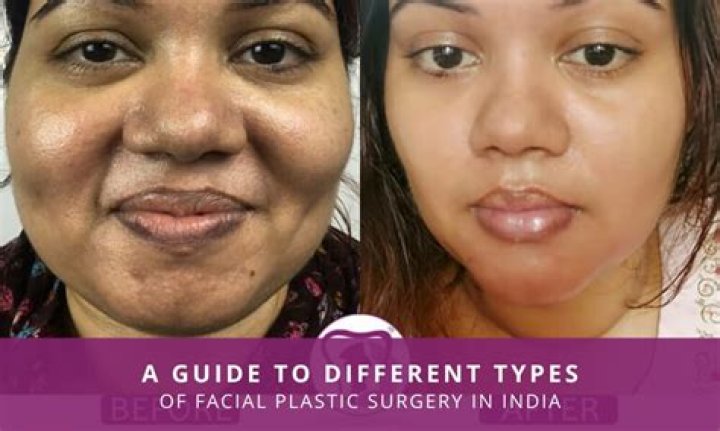 The Truth Behind Zoe Saldana's Nose: Plastic Surgery Or Natural?