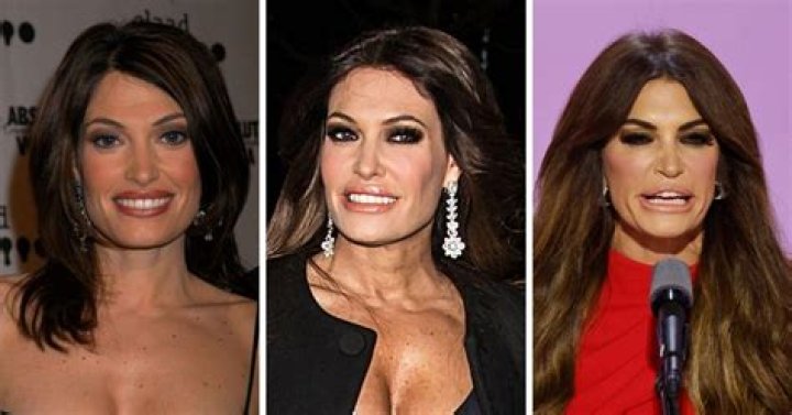 Transforming Elegance: The Kimberly Guilfoyle Makeover Journey