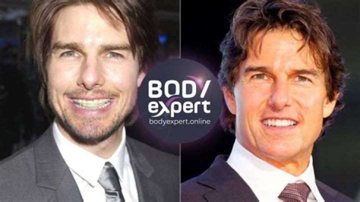 Truth Behind Celebrities' Dental Struggles