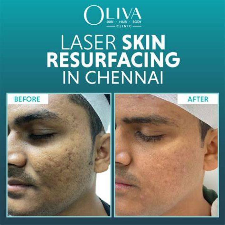 Ultimate Skin Rejuvenation: Rediscover Youthful Radiance