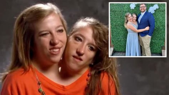 Uncover Hidden Truths: Conjoined Twins On TV