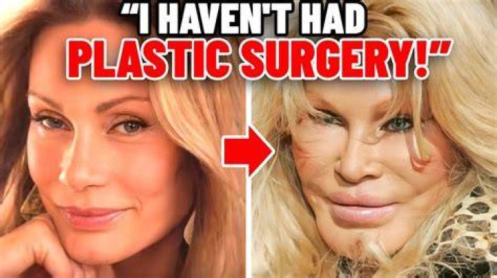 Uncover The Secrets Of Plastic Surgery With Renowned Surgeon Peter Colbert