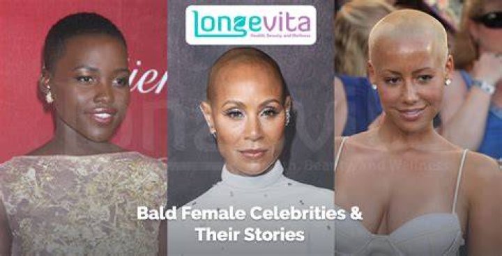 Uncovering The World Of Bald Female Celebrities