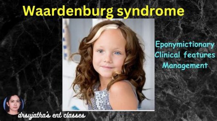 Understanding Henning Wehn's Waardenburg Syndrome