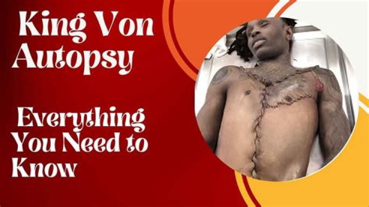 Understanding The King Von Dead Autopsy: What Really Happened?