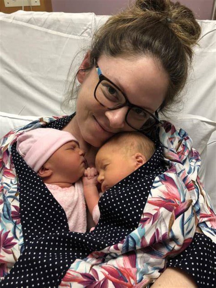 Unique Journey: Conjoined Twins Pregnant
