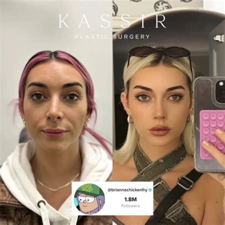 Unlocking The Truths Of Brianna Lapaglia's Plastic Surgery Journey