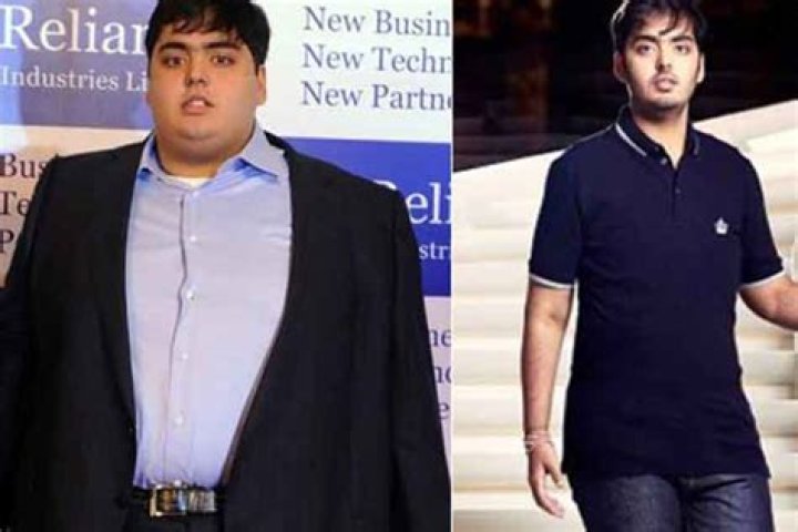 Unraveling Anant Ambani's Physical Health Journey