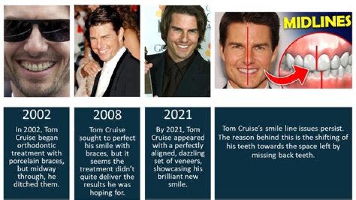 Unraveling The Health Mysteries Of Tom Cruise