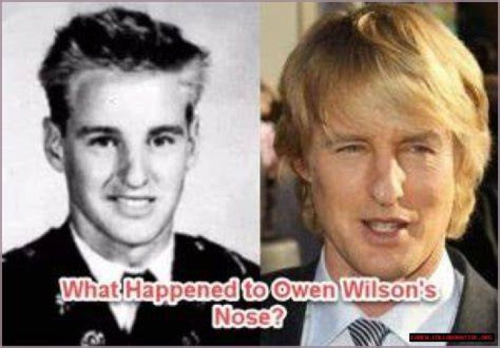 Unraveling The Mystery: Owen Wilson And His Nose