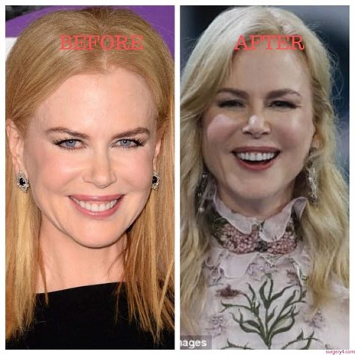 Unveiling Nicole Kidman's Age: A Journey Through Time
